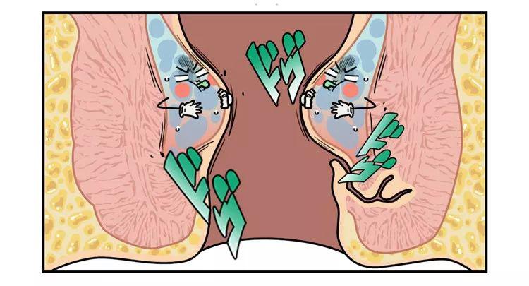 人類的痔瘡到底是多大的疼痛?_肛門