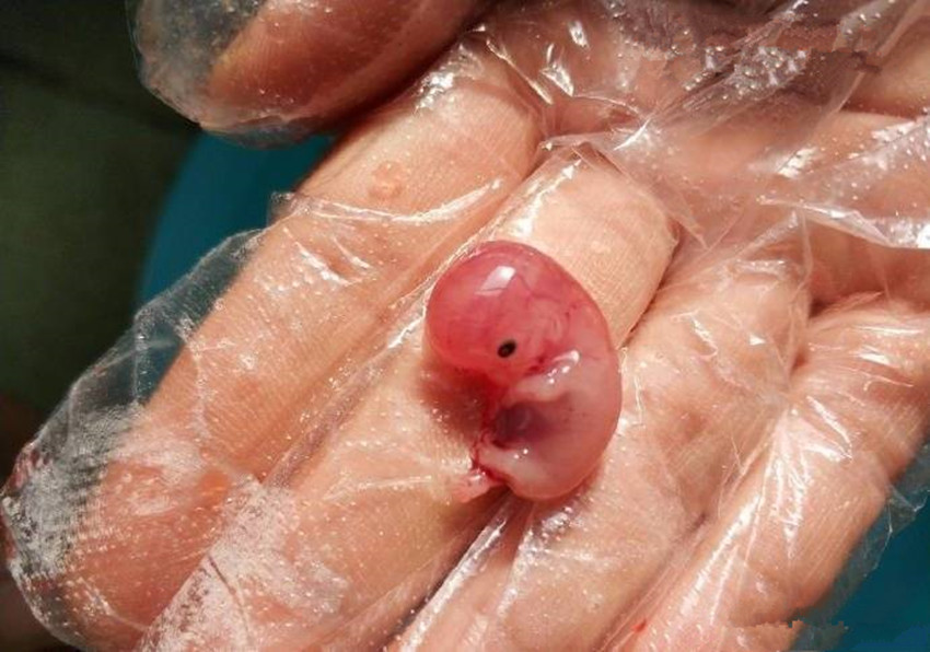 两个月流出来胚胎图片图片