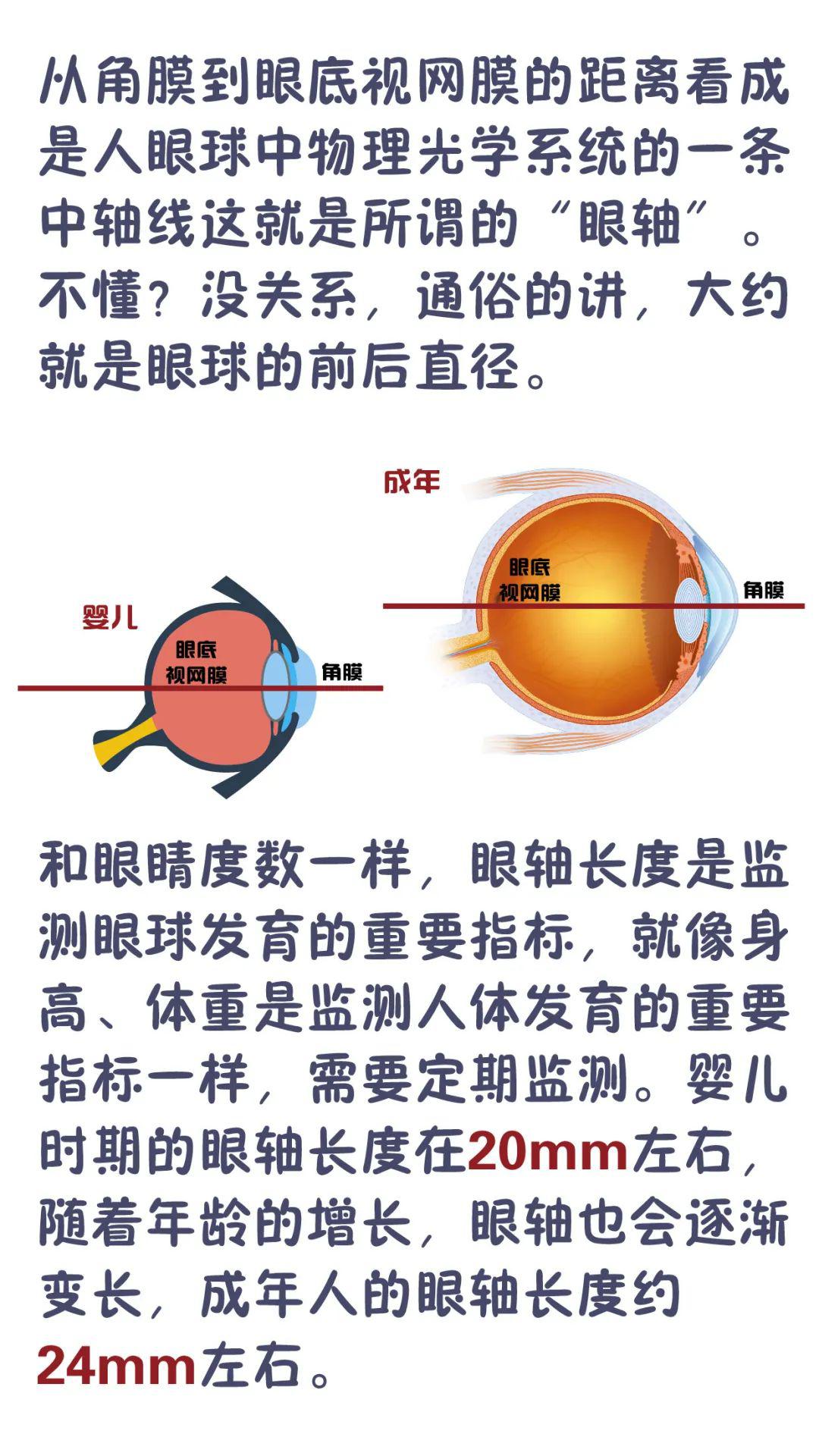 验光配镜时为什么需要测量眼轴长度