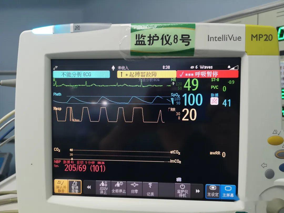 心电监护仪死亡图片