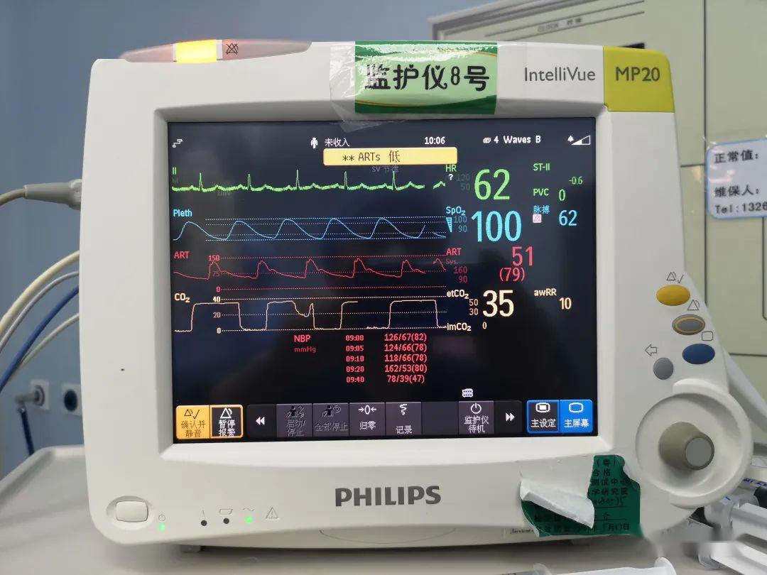 极度风险三度房室传导阻滞