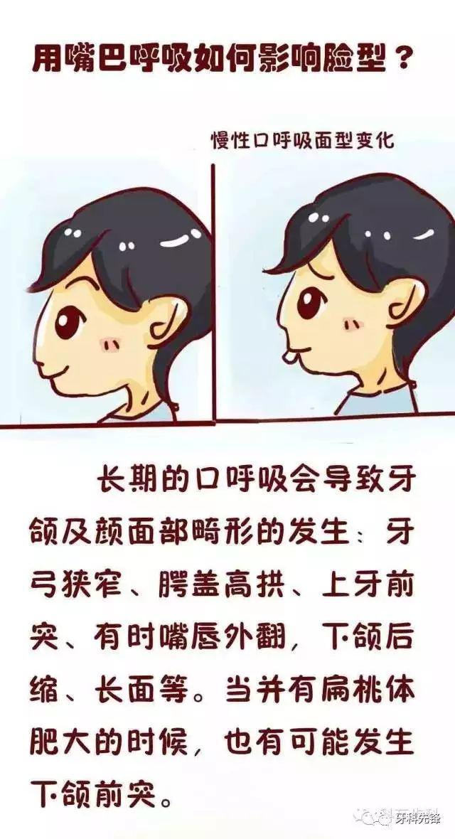 【科普漫画】孩子口呼吸真不是件小事?