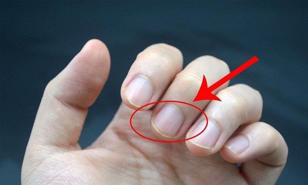 原创孕期如何检测是否贫血试试听看问查四步法在家也能知道