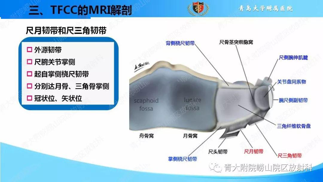 tfcc损伤的mri诊断