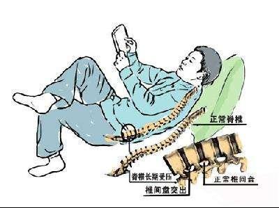 坐出来的腰椎病这些常见舒适坐姿其实最伤腰原创
