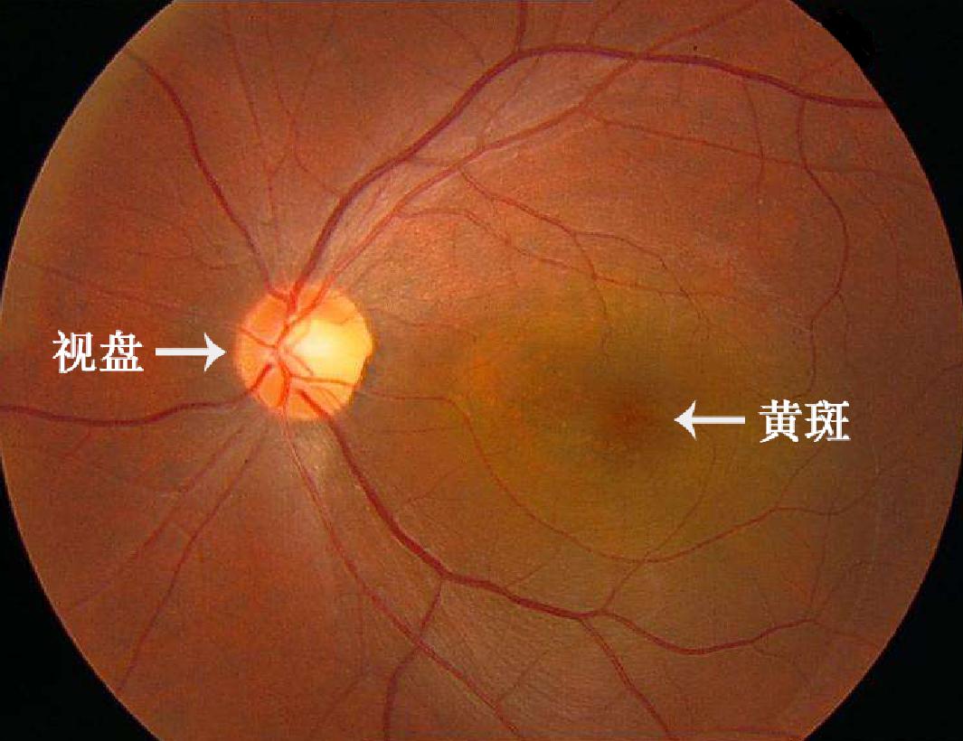 硬核科普我叫黄斑大家都叫我眼底的心脏文末有彩蛋