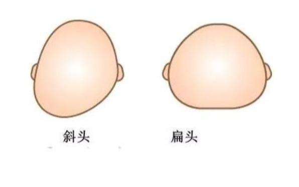 孩子后脑勺高就是聪明吗父母不要再被误导信玄学不如信科学