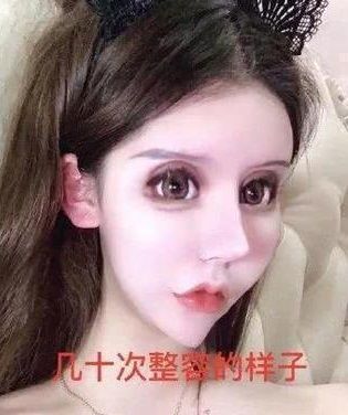13岁女孩疯狂整容60次花费百万畸形的审美观会毁了孩子