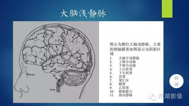 头颅血管解剖图图片