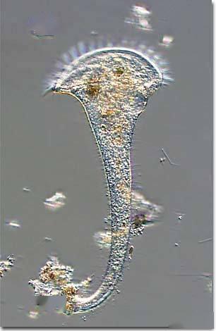 水里的微生物图片大全图片