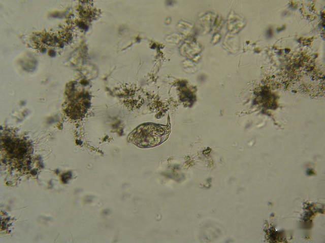 一滴水里的微生物图片图片