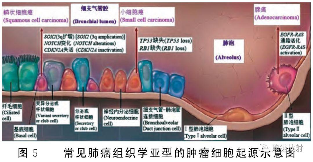 肺癌种类图片