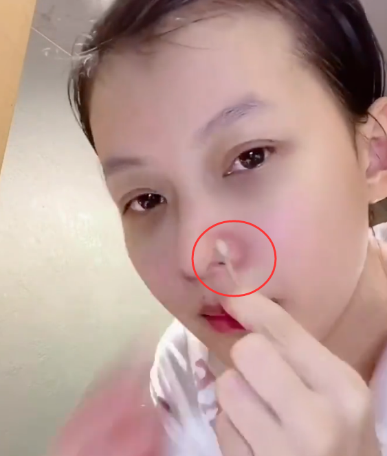 别人都用手挤黑头孙怡却不是看清她的做法多数女生第一次见