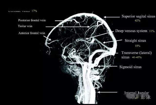 头颅血管解剖图图片
