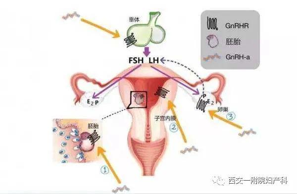 gnrha是一种人工合成的十肽类化合物,即促性腺激素释放激素激动剂,其