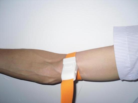 四肢外伤出血,一般采用棉纱布填塞加压包扎等法暂时止血;没有条件的