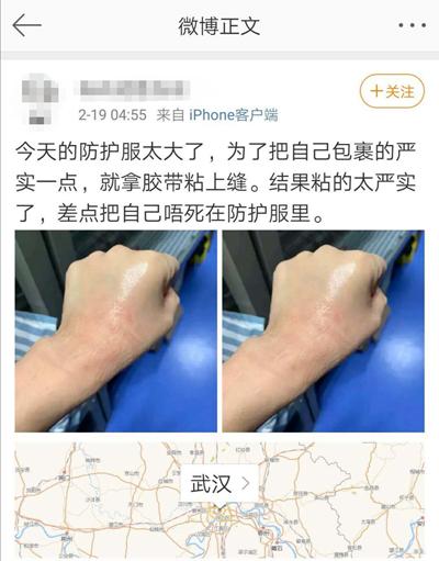 衣架打的红痕图片图片