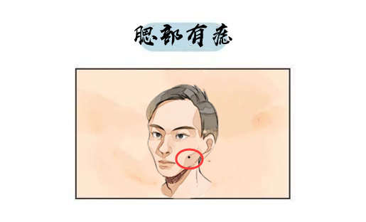 原创身体4颗破财痣留不得花钱大手苦日子难翻身必须点掉