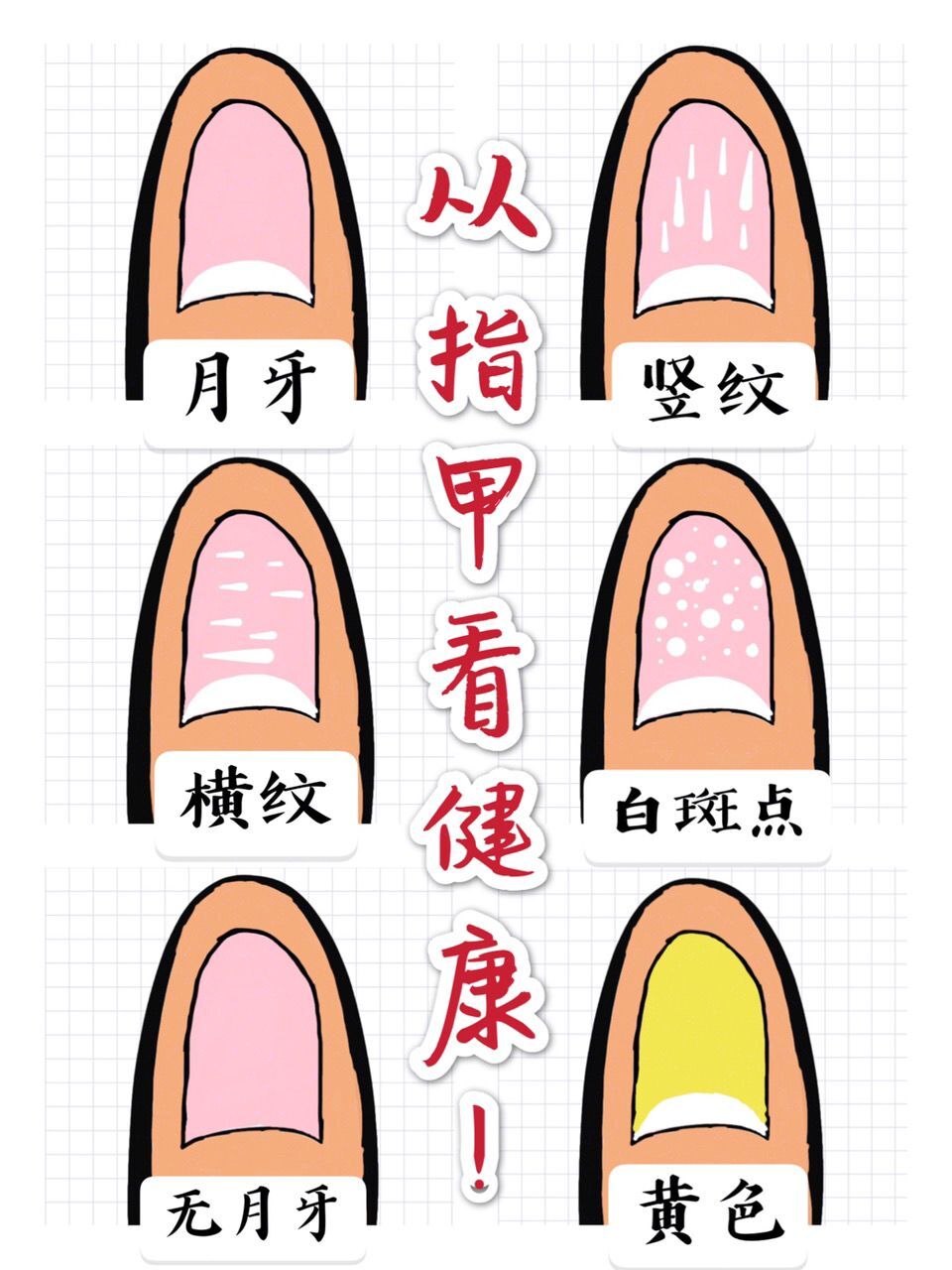 身体健康预警当你手指的月牙有了这些变化
