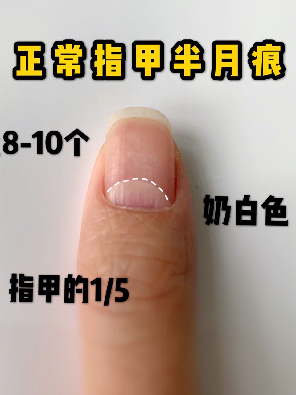 见正常指甲的半月痕相信很多小伙伴也都听说过手指甲上的月牙可以反映