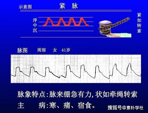 脉诊的核心部分正常脉象与病理脉象各是什么触感