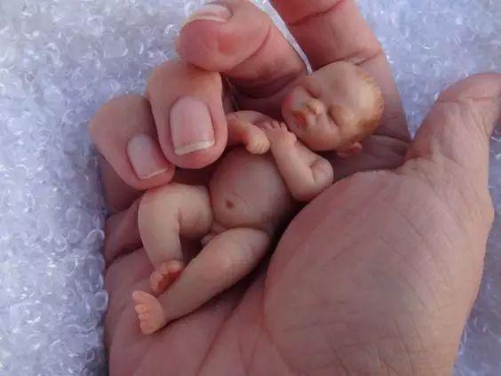 也是为了强调每个孩子都是母亲眼里的珍宝吧,或套用一句中国的成语,掌