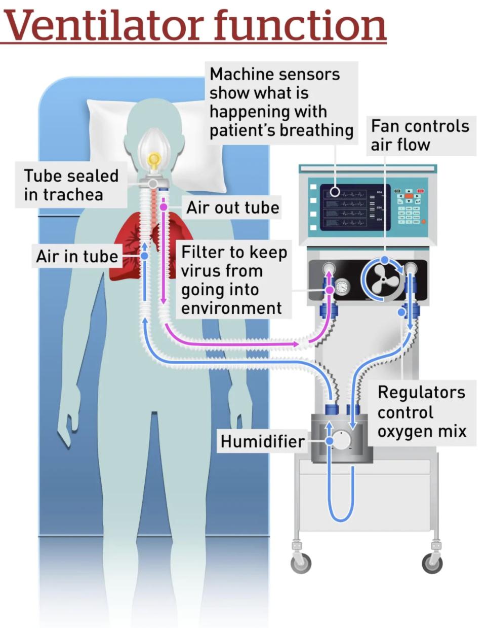 呼吸机连接示意图图片