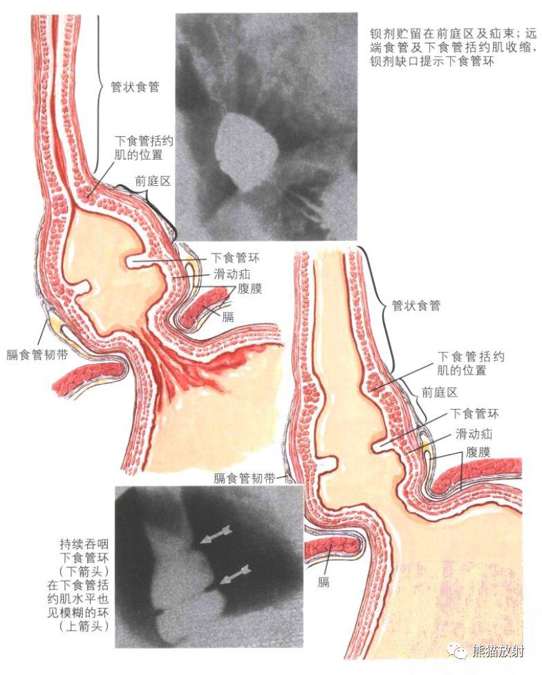 食管齿状线解剖图片