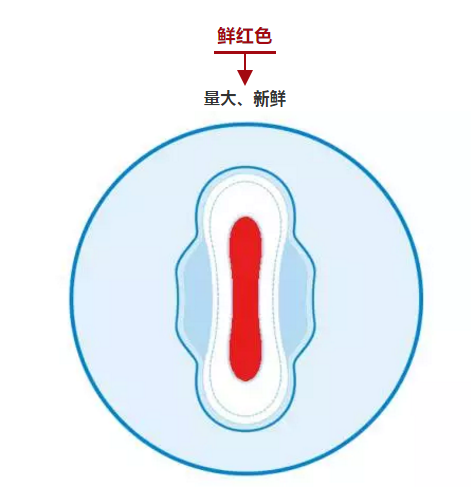 30毫升月经量图片正常图片