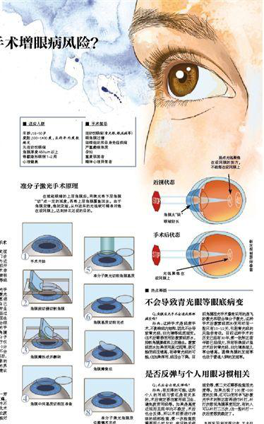 其三,术前检查眼睛的屈光系统是一个较为复杂的系统,物体成像要经过
