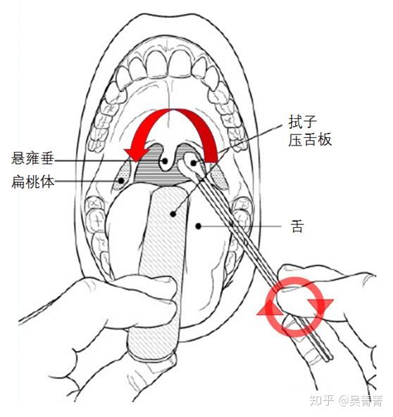 口腔拭子采集方法图解图片