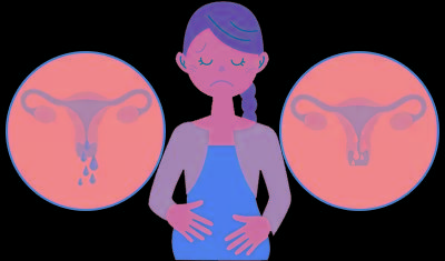 输卵管造影(hsg)或生理盐水超声宫腔造影(shg)来诊断asherman综合征