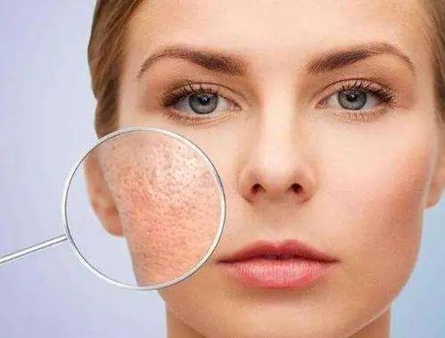 卸妆不干净烂脸