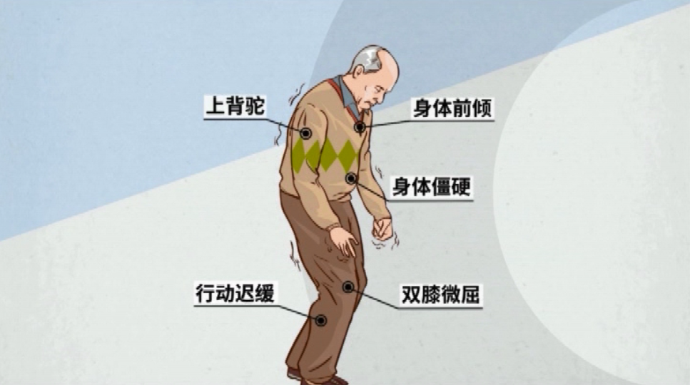上海电视台受邀专家郭辉教授讲解老年人手抖僵硬腿脚不听使唤怎么办