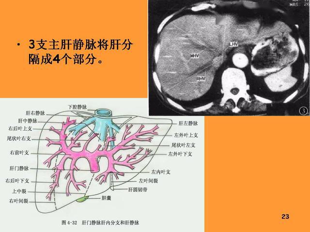 肝臟的解剖和分段