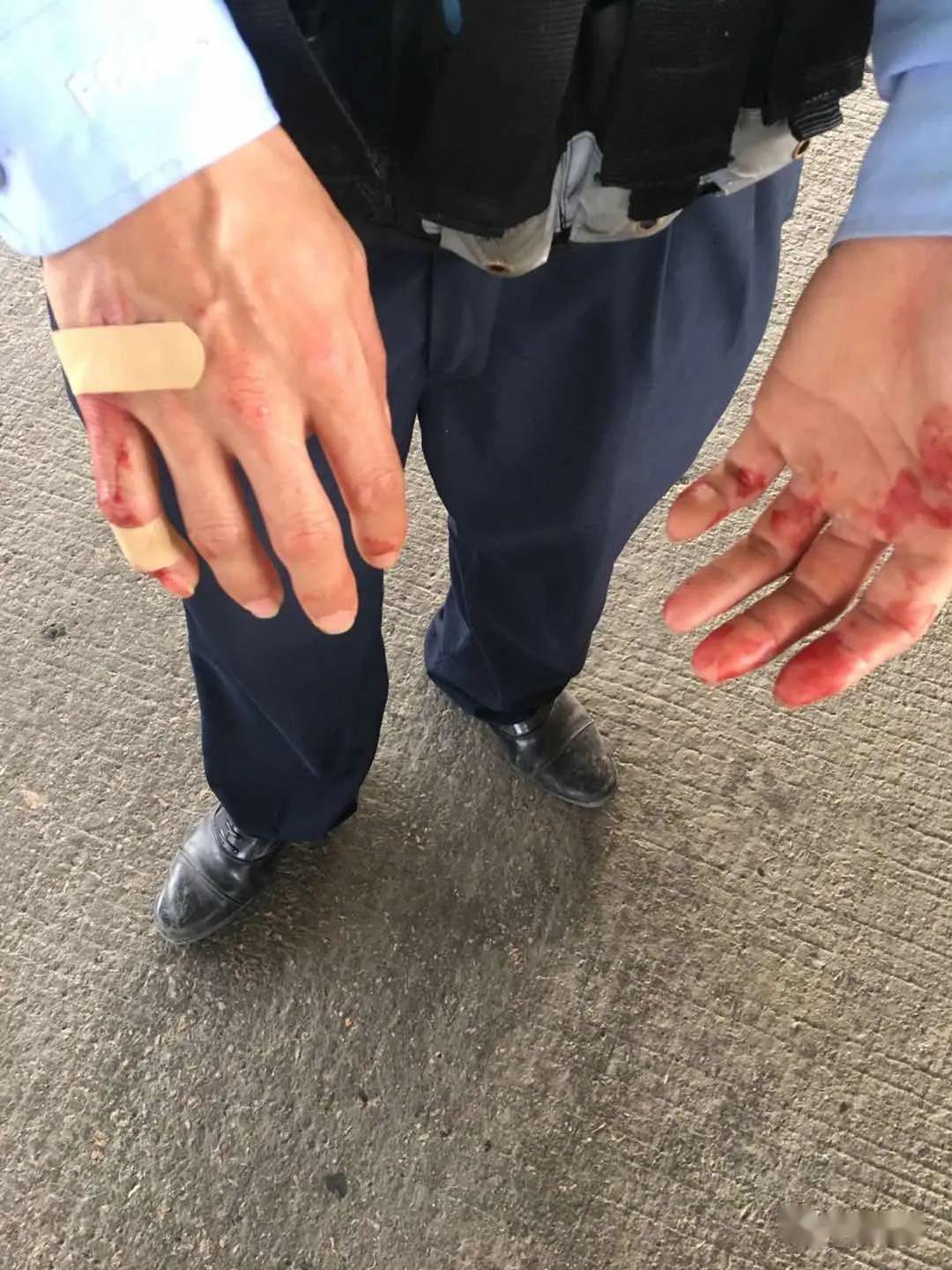 廉江惊现一小车撞上隔离墙仰翻四脚朝天!竟是因为