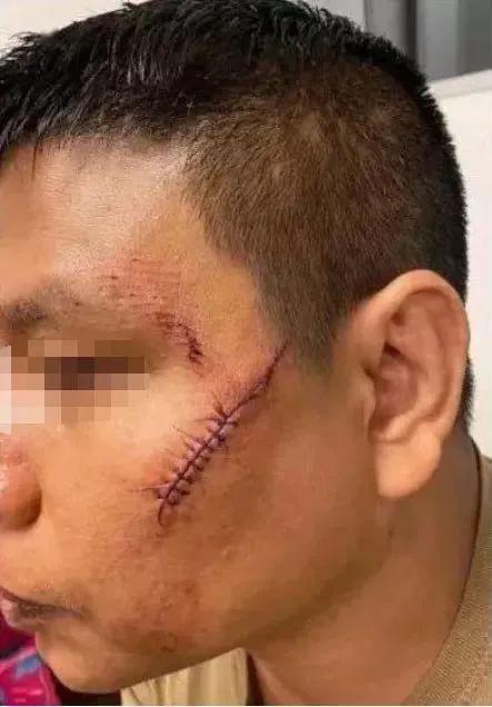 滑大教授公然辱华多伦多亚裔女生被骂病毒婊子歧视事件的背后是