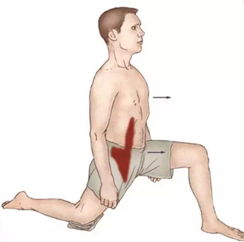 腰疼补肾肾虚症状只是表象本质可能腰部肌肉出现了损伤