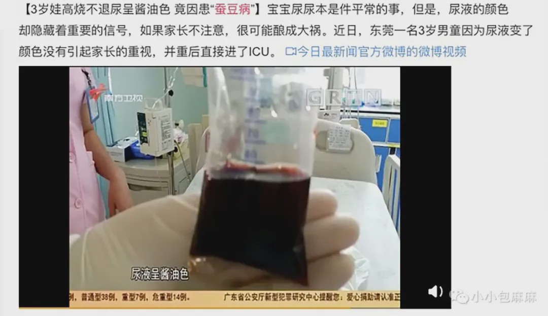 4岁男孩突发尿血 ,只因吃了两口这道家常菜,家有男孩尤其注意!