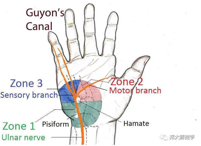 腕部神经卡压腕尺管综合征