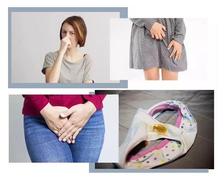 意料之中,开始白带异常,分泌物有鱼腥臭味,下体发痒,挠到红肿溃烂.