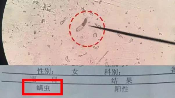 橘子皮分泌腔显微镜图图片