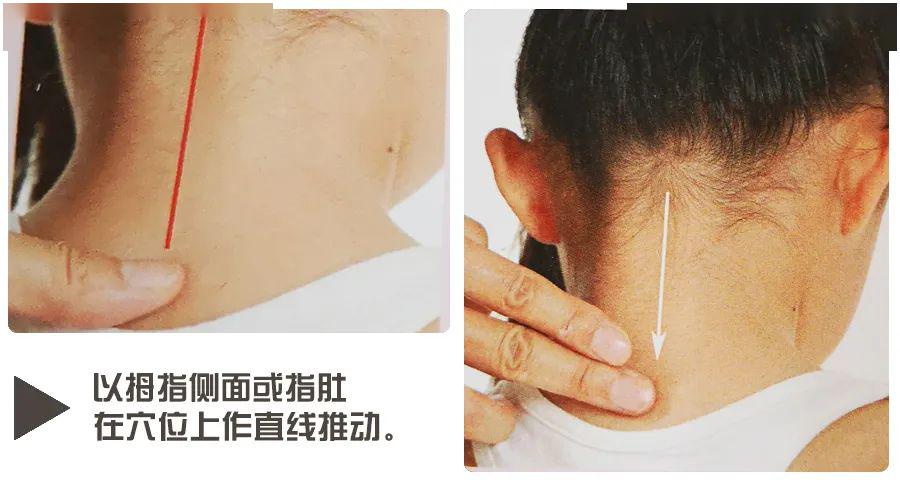 手法:推法,以拇指侧面或指肚,在穴位上作直线推动.