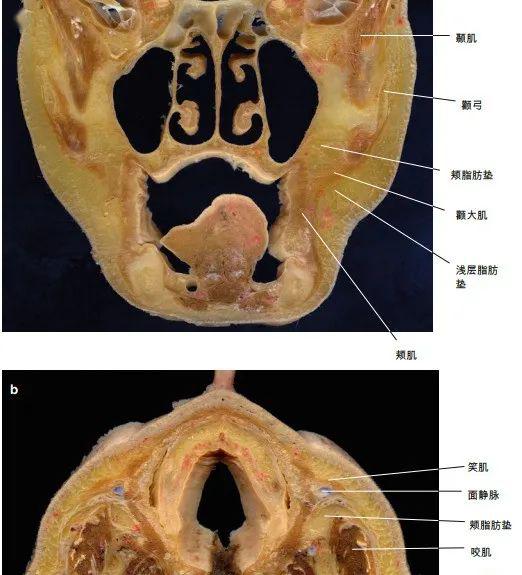 美容解剖学美的秘诀