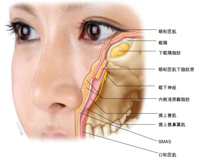 低头时从上面会更容易看到凹陷眼睛和眶周区各部位的基本解剖学结构a