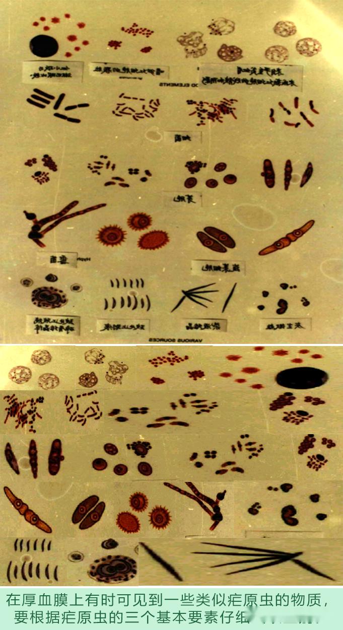 疟原虫各期手绘图图片
