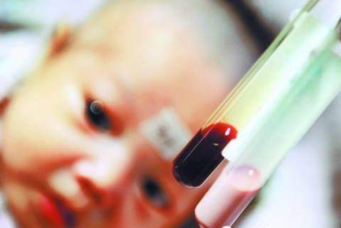 很多人不知道人体的血液还有各种颜色从血液颜色看人体健康