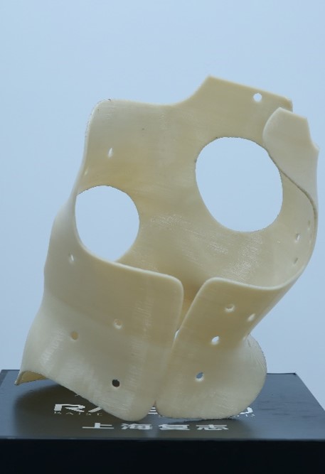 3d打印脊椎侧弯矫正器