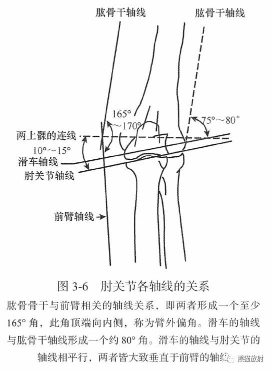 衡量骨与关节的整复或矫形术后其对位对线关系是否合适;判断骨折,脱位
