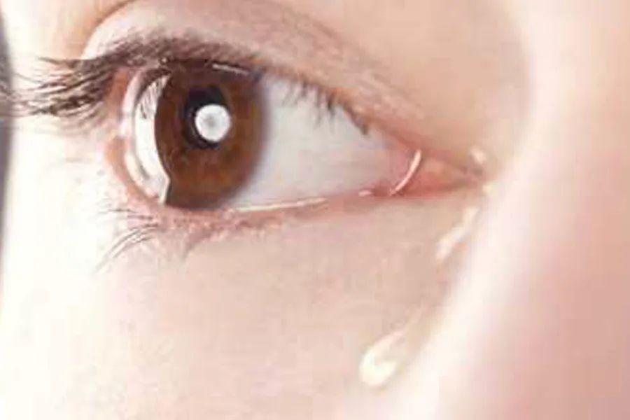 春季小心眼睛发红的红眼病必须引起注意
